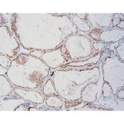 CD56, anitbody kits